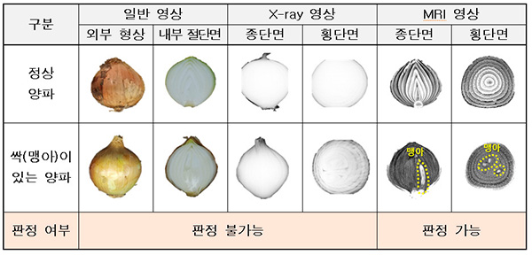 X-ray와 MRI 싹(맹아)